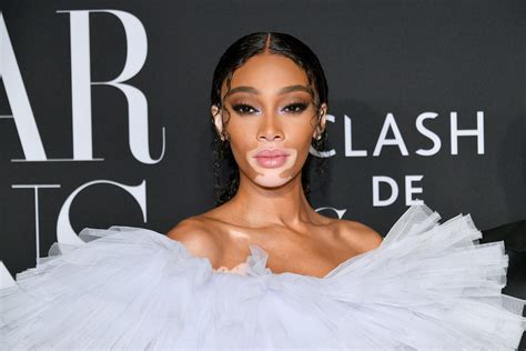 winnie harlow net worth|Winnie Harlow Net Worth – Equity Atlas